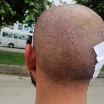 İmperial Hastanesi Usulsüz Ücret Talebi