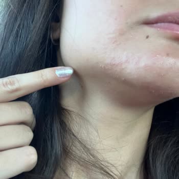 Maruderm Yüz Yıkama Jeli İlk Kullanımda Yüzümü Mahvetti