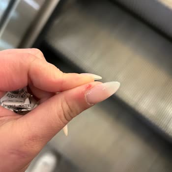 Tırnakçım Hakkında Şikayetim