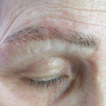 Bi'Güzellik Beauty Room Kaş ,Dudak İşlemi