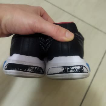 Skechers Ürünün Arkasında Durmuyor