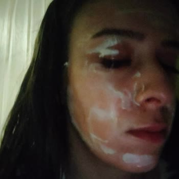Elidor Onarıcı Şampuan Alerji Yanık Yaptı