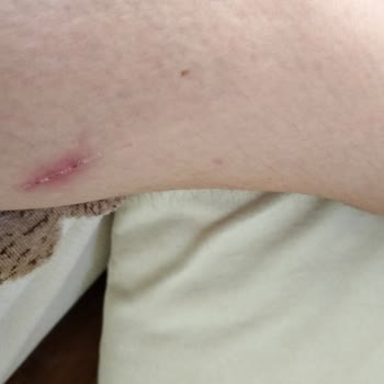 Gillette Venüs Kesti Her Yerimi