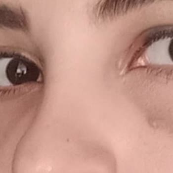 Op. Dr. Belma Kapılı 'ya Göz Altı Işık Dolgusu Yaptırdım, Memnun Kalmadım