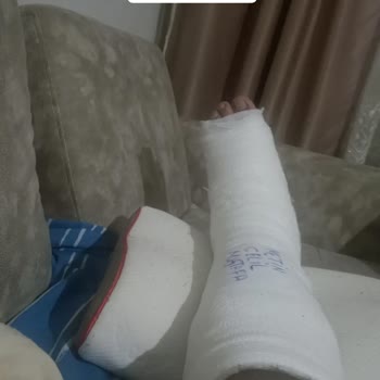 Gölbaşı Belediyesi İhmal Sonucu Ağır Yaralanmalı Kaza