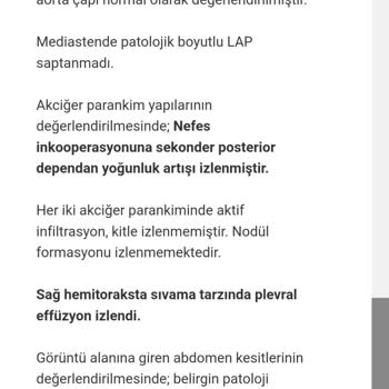 Gölbaşı Belediyesi İhmal Sonucu Ağır Yaralanmalı Kaza