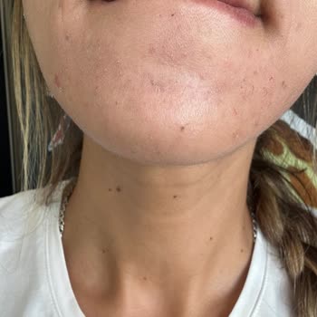 Nivea Güneş Koruyucu Ama Korumayan