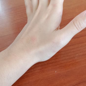 İzmir Büyükşehir Belediyesi Belediye İlaçlama Yapmaması