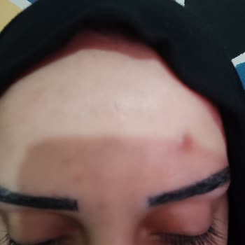 Trendyol Sinoz Güneş Kremi Yüzümü Mahvetti