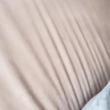 Mondi Müşteri Hizmetlerinden Ve Almış Olduğum Kumaştan Kaynaklı Sıkıntı