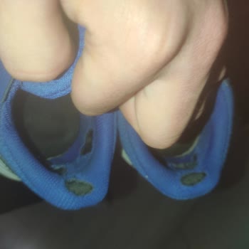 Adidas'ın Garantisi Çok Kötü