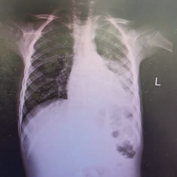 Özel İlgi Çocuk Sağlığı Merkezi (Gebze)'nde Yanlış Tedavi Uygulanan Çocuğum