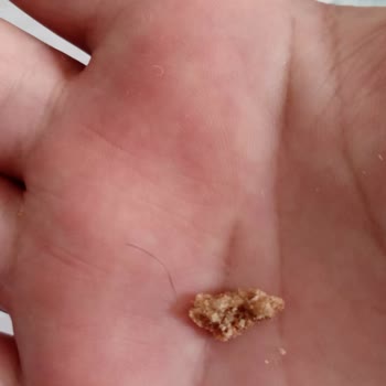 ebebek Bebek Bisküvisinden Kıl Çıkmıştır
