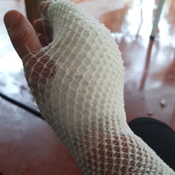 Stanley Termos Elimde Patladı