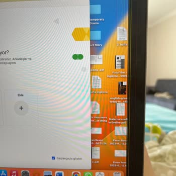 Apple Macbook M1 Piksel Kaybı