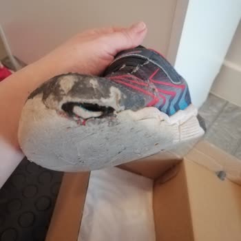Skechers Marka Ayakkabı 3 Ayda Resmen Delindi! Üründe Kusur Yokmuş!
