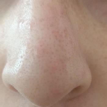 Trendyol Rise&shine İlk Kez Böyle Bir Şey İle Karşılaştım