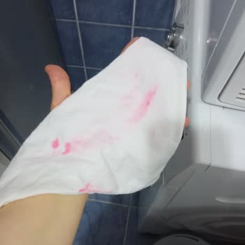 Domestos Çamaşır Suyu Beyaz Ürünü Koyu Pembe Leke Yaptı