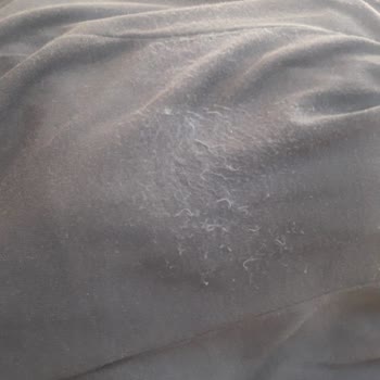 Oysho Mağazasından Aldığım Üründe Deformasyon Var