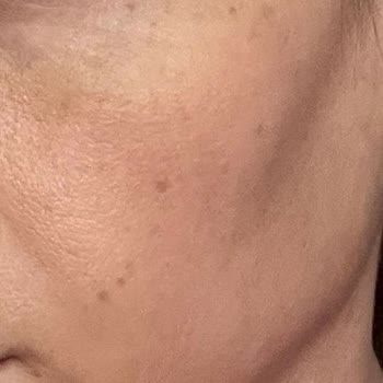 Zaradis Güzellik Merkezi Rose Peeling ( Mercan ) İşe Yaramadı Ve Döneceğiz Deyip Dönmüyorlar