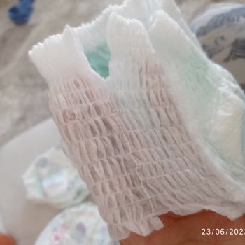 Molfix Külot Bez Yırtılması