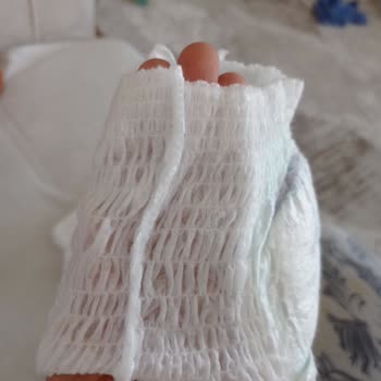 Molfix Külot Bez Yırtılması