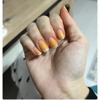 Flormar Ürünü Tırnaklarımı Bozdu