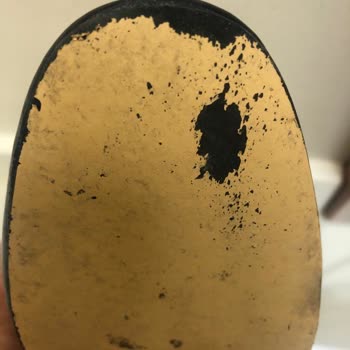 Lutvelizade 2 Saatte Çöp Olan Ayakkabıyı Satıp Sonrasında Yardımcı Olmuyorlar