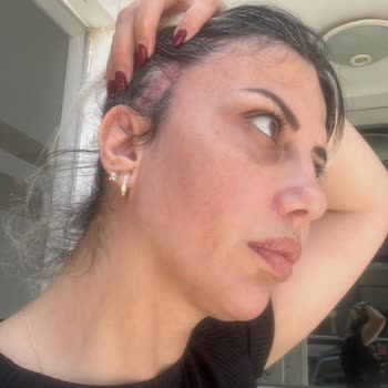 Nara Clinique Yüz Germe Ameliyatında Tehlike