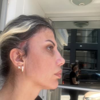 Nara Clinique Yüz Germe Ameliyatında Tehlike