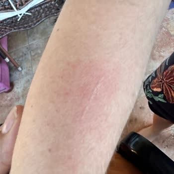 Medicell Tıp Merkezi Acil Yaralanma Bedeli