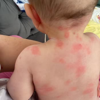 Hipp Mama Bebeğimi Zehirledi