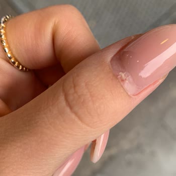 Dilara Özbek Nail Studio Tırnağıma Mantar Bulaştırdı
