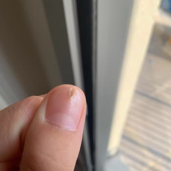 Dilara Özbek Nail Studio Tırnağıma Mantar Bulaştırdı