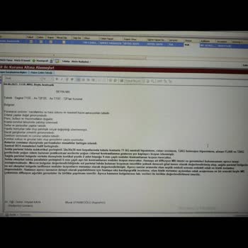 Sağlık Bakanlığı Biontech Böbreğimi İflas Ettirdi