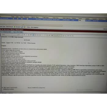 Sağlık Bakanlığı Biontech Böbreğimi İflas Ettirdi