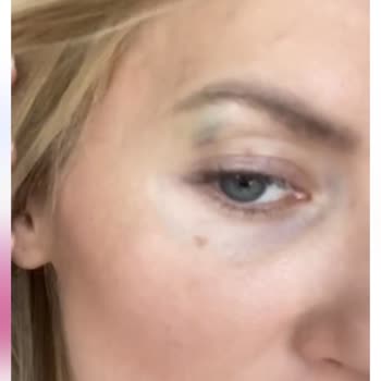 Dr. Can Taşkıran Yanlış İşlem, Asimetrik, Çukur