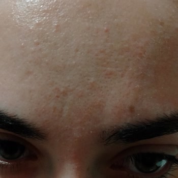 Herbaderm Cilt Rengi Açıcı Krem