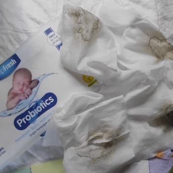 Aksan Kozmetik Firmasına Ait Probiyotikli Islak Mendil Küflü Çıktı