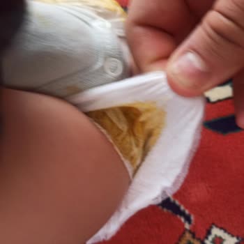 Sızdıran Purebaby Bebek Bezi