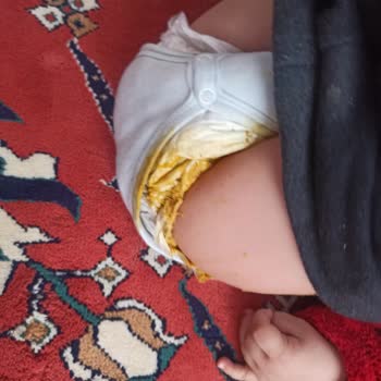 Sızdıran Purebaby Bebek Bezi