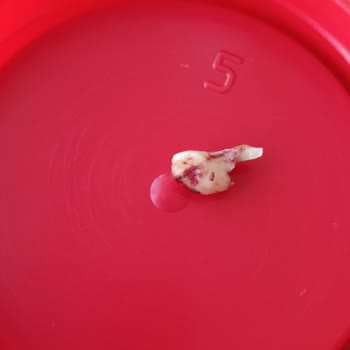 Özel Arma Ağız ve Diş Sağlığı Polikliniği Arma İlgisi Ve İmplant İşlemi