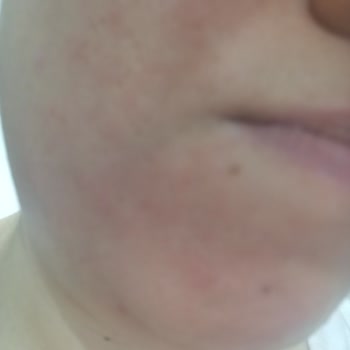 Garnier Ambre Solaire Güneş Kremi Cildimi Yaktı