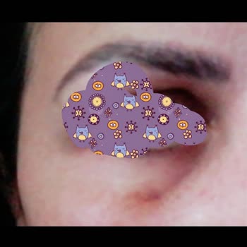 Dr. Mustafa Ekmen Klinikte Botox Mezoterapi Uygulaması Zarar Verdi!