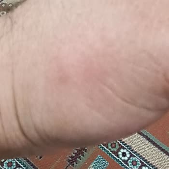 Raid Elektrolikit İşe Yaramıyor