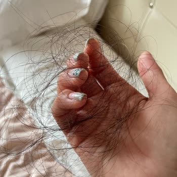 Yalçın Akbaba Hair Designer Saç Kaynağı Sorunu