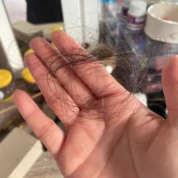 Yalçın Akbaba Hair Designer Saç Kaynağı Sorunu