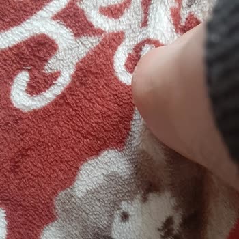 Nike Ayak Bilek Üst Kısımda Kalıcı Hasarlar Ve Yaralar