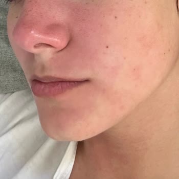 Eyüp Sabri Tuncer Gül Suyu Suratımı Yaktı