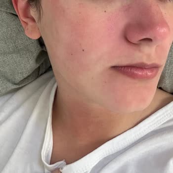 Eyüp Sabri Tuncer Gül Suyu Suratımı Yaktı